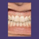 Smile Creator