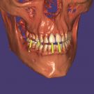 DICOM Viewer