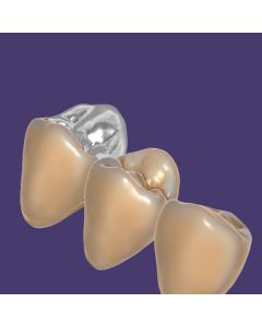 TruSmile Module