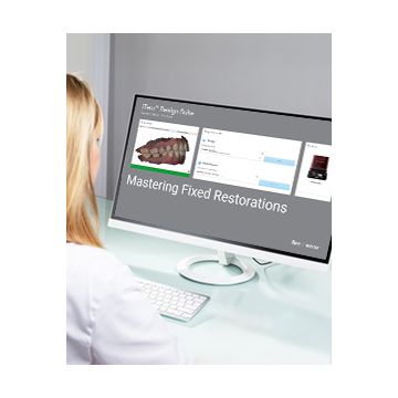 Mastering Fixed Restorations - iTero™ Design Suite